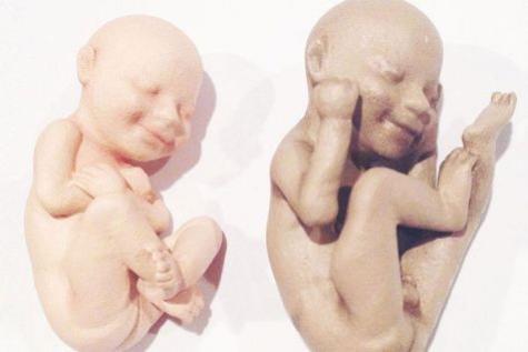 foetus-bebe-3d