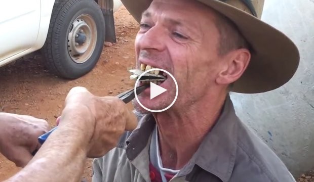 Une technique australienne insolite pour arracher des dents!