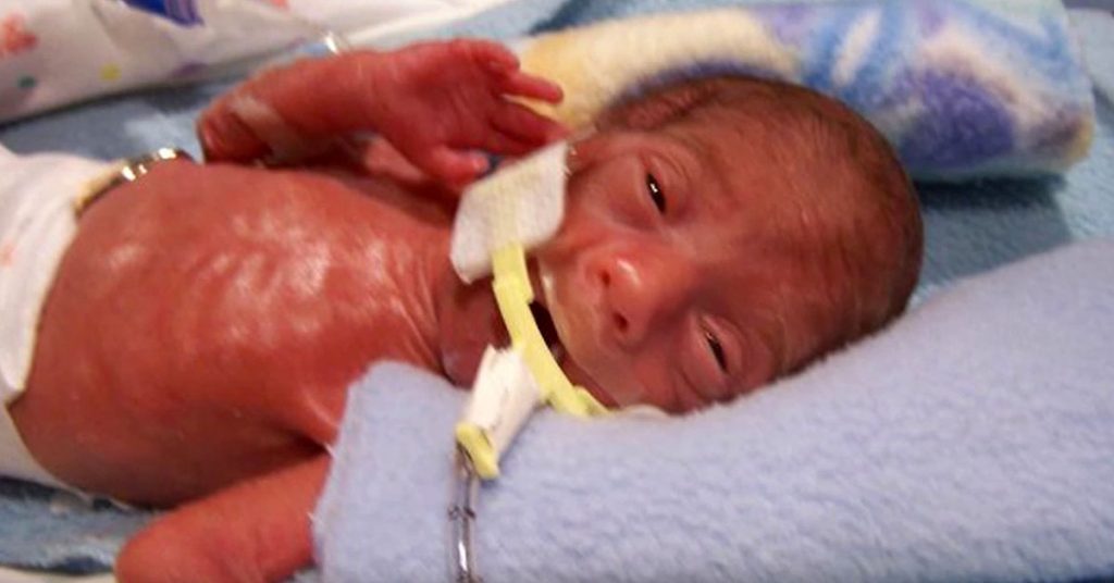 L’infirmière ignore si cet enfant survivra. Quelques années plus tard, elle fond en larmes…