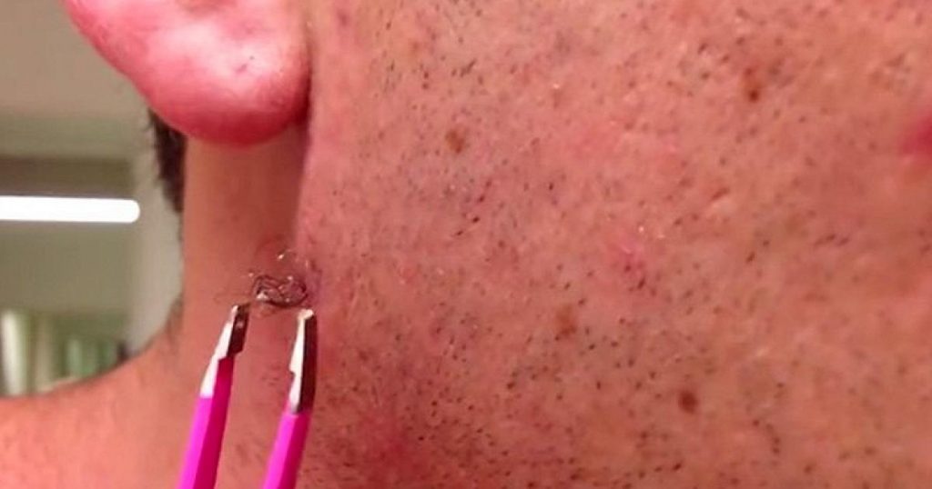 Il essaye d’arracher un poil vieux d’un an. Ce qu’il découvre est… hallucinant !