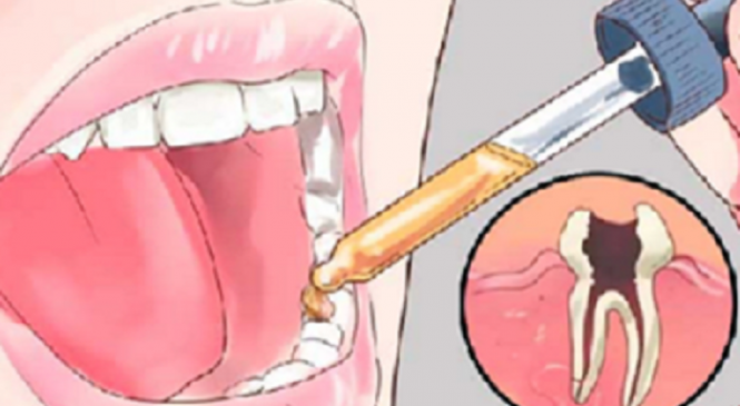Mettez cette solution dans votre bouche et les maux de dents vont disparaître en une seconde