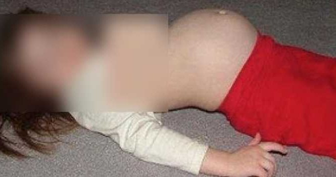 Paraguay : Mainumby, la fillette de 11 ans, a accouché