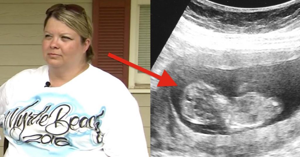 Cette femme a eu le choc de sa vie en découvrant son échographie! Ce que le médecin lui révèle fait l’effet d’une bombe!