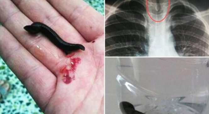 Il n’arrive plus du TOUT à respirer, ce que les médecins trouvent dans sa gorge glacent le sang!
