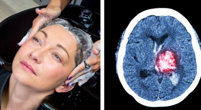 Elle a frôlé la mort dans un salon de coiffure .. aujourd’hui elle nous prévient du danger !
