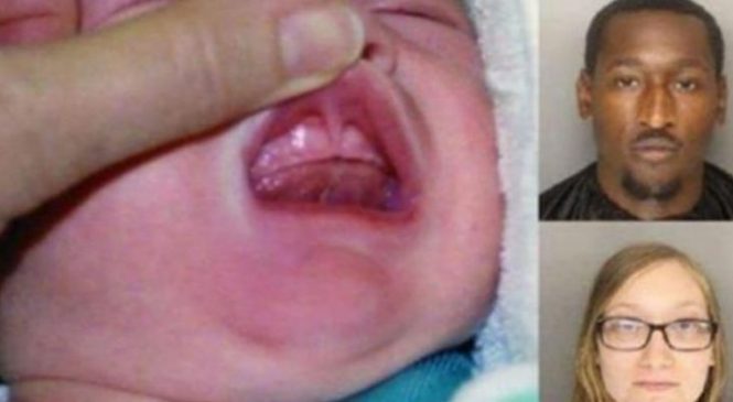 Le docteur regarde la bouche de ce bébé, puis la police arrête les parents. Ce qu’ils ont fait est inimaginable!