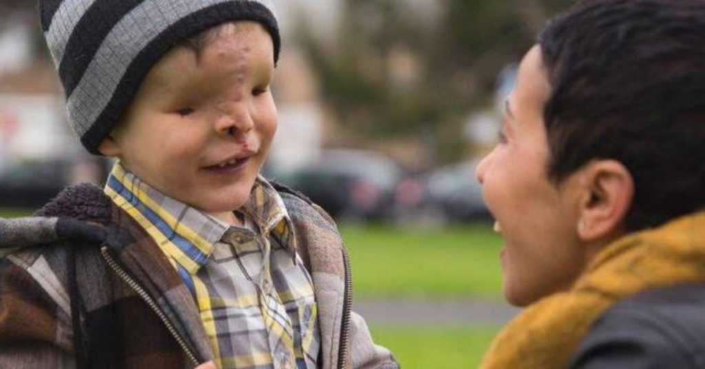 Ce garçon sans visage quitte son pays pendant 2 ans. Quand il revient, sa famille ne peut pas en croire ses yeux !