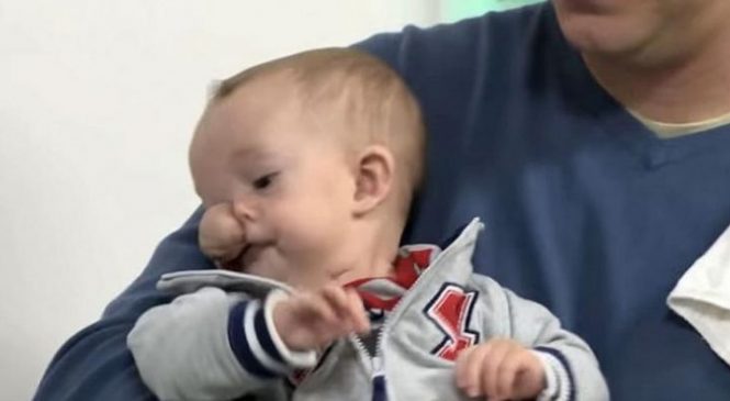 Le papa aperçoit une étrange bosse sur la tête de son fils, puis c’est la catastrophe!