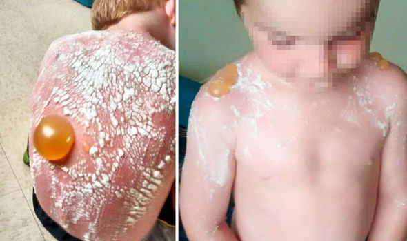 Son fils pleurait de douleur quand elle est allée le chercher à la crèche, ce qu’elle a découvert est le cauchemar de toutes les mamans !