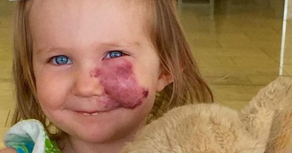 Une petite fille remarque la réaction des autres devant sa tache de naissance et ce qu’elle fait ensuite bouleverse sa maman