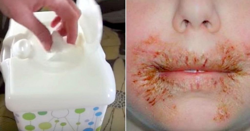 Les médecins réputés avertissent les parents de ne jamais nettoyer le visage des enfants avec des lingettes pour bébé!